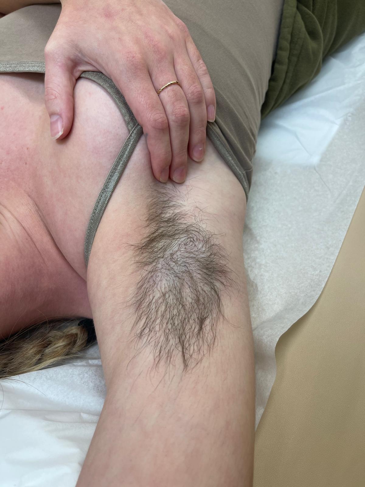 Before Brazilian wax treatment, example 5